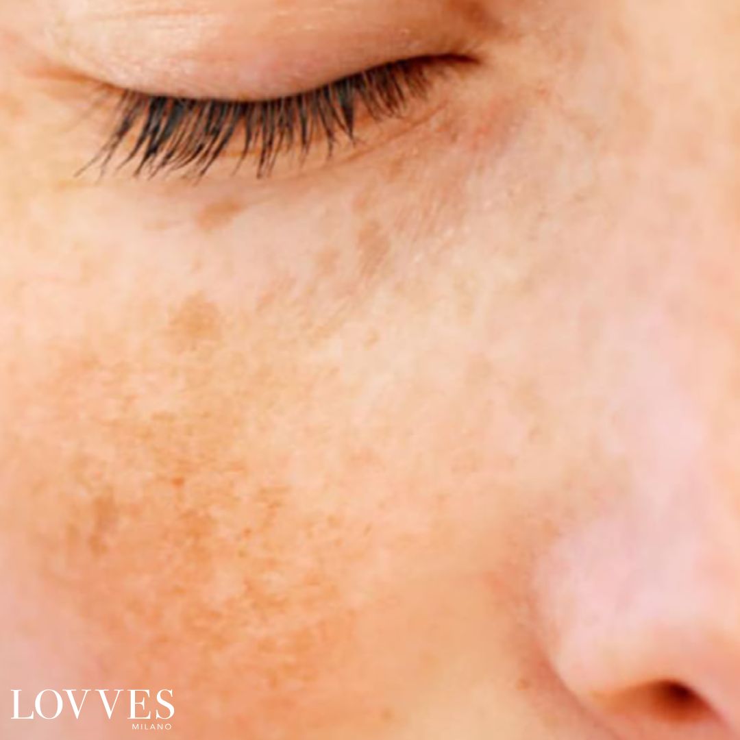 Sérum Éclaircissant Taches Visage Dépigmentant