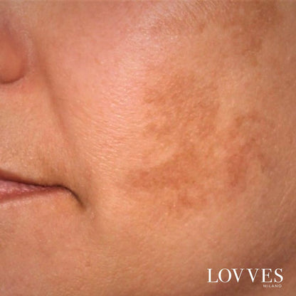 Sérum Éclaircissant Taches Visage Dépigmentant