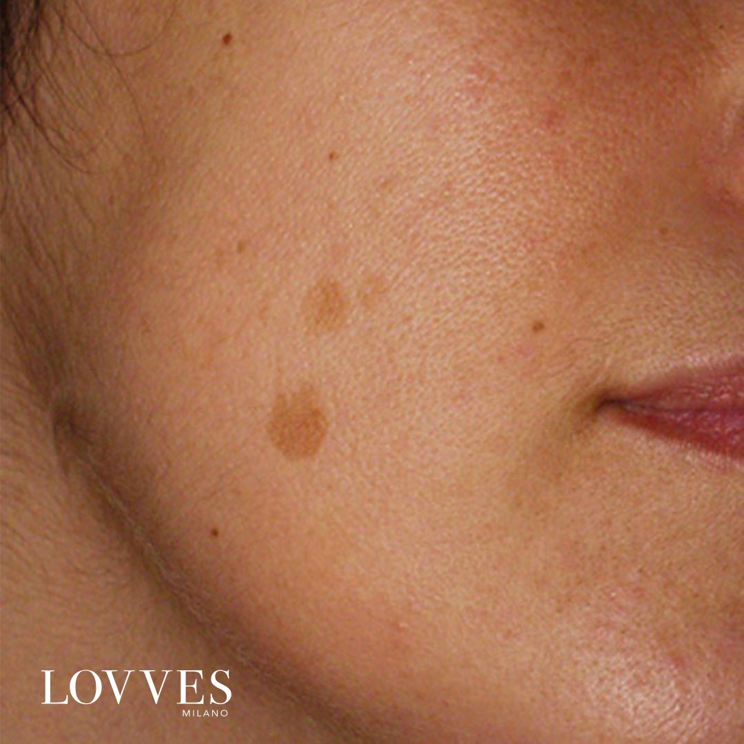 Sérum Éclaircissant Taches Visage Dépigmentant