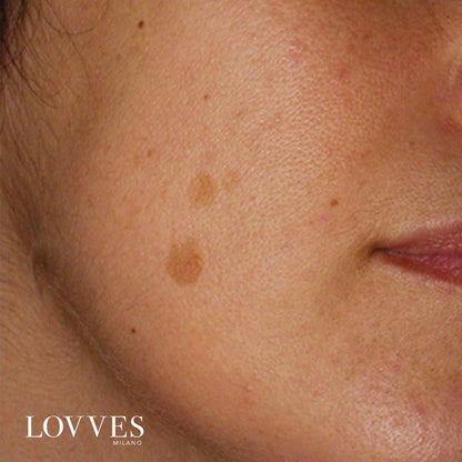 Sérum Éclaircissant Taches Visage Dépigmentant